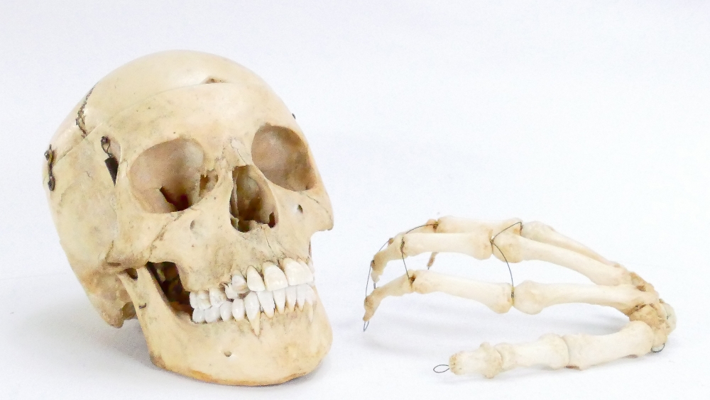 20th century human skull and hand: Purchased previously some years ago from a London auction rooms,