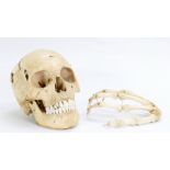 20th century human skull and hand: Purchased previously some years ago from a London auction rooms,