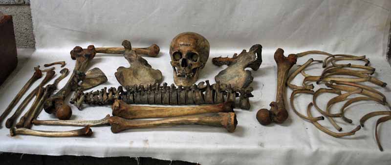 Anatomy - an early 20th century partial Human Skeleton, including skull, contained in a pine box