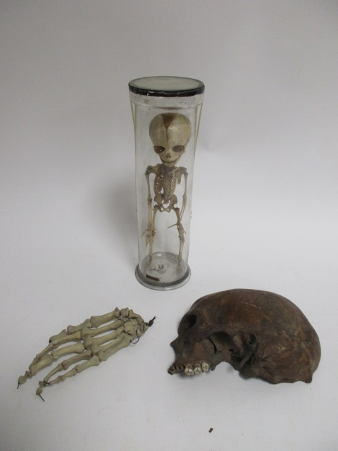 A pre-war teaching aid of a human baby skeleton, within a glass case, height 30.5cm, together with a