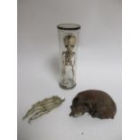 A pre-war teaching aid of a human baby skeleton, within a glass case, height 30.5cm, together with a