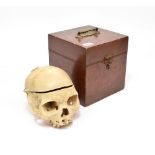 Human Skull with removable top section, in stained wood case (some damage)