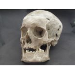 A human skull