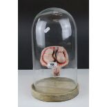 Anatomical Educational Teaching Model of Twin Babies in a Womb contained within a Glass Dome,