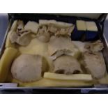A disarticulated human skull dissected in ten sections
