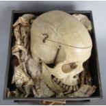 Human skull with hinged jaw and removable cranium, formerly the property of a local doctor, 16 cm