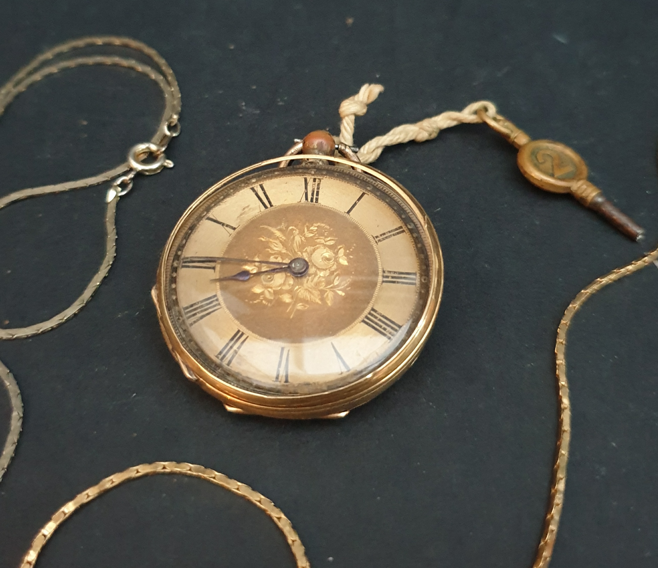 Antique Gold Coloured Metal Pocket Watch & Two Chains - Image 3 of 4