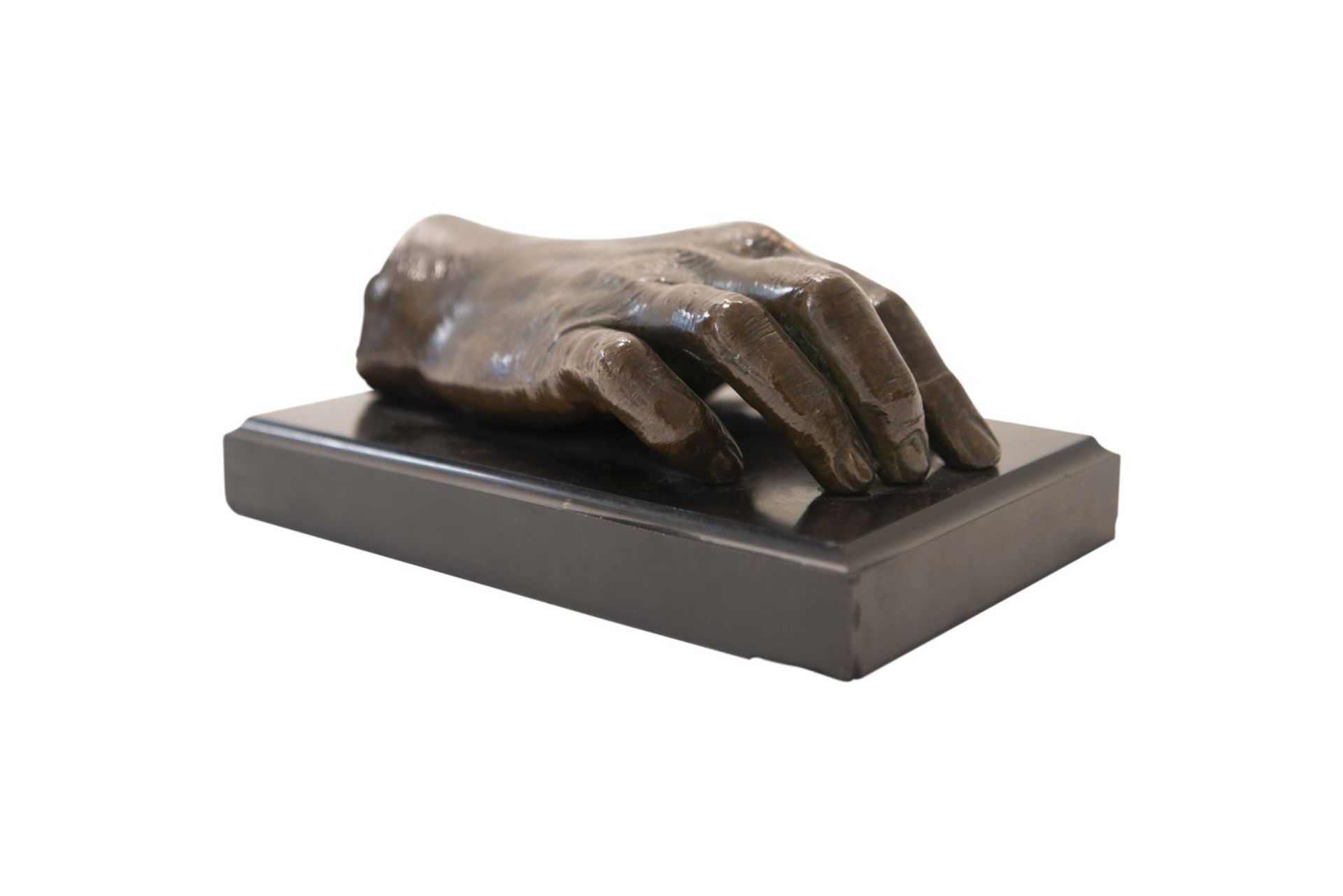 Right hand made of cast bronze after an impression of the hand of Dr. Ferdinand Sauerbruch