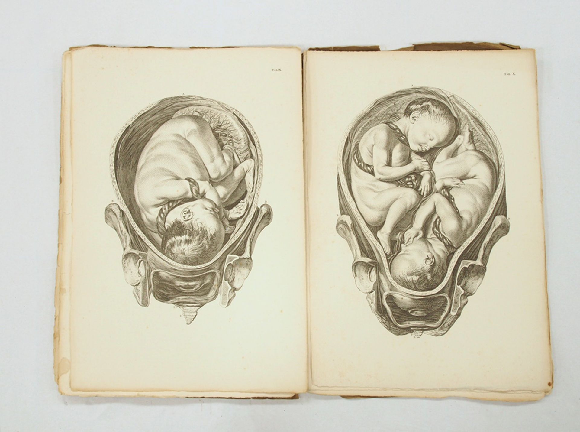 SMELLIE, William: A set of Anatomical Tables...First Part - Image 2 of 3