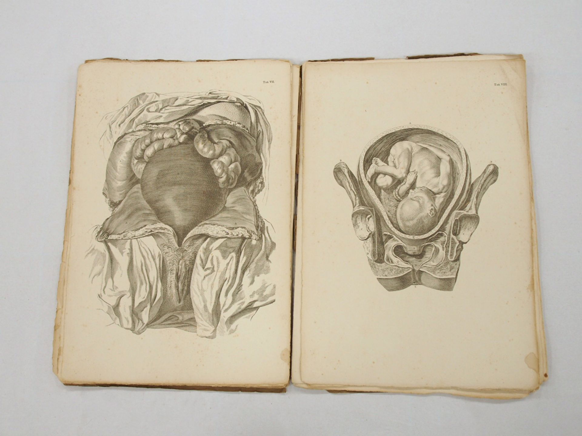SMELLIE, William: A set of Anatomical Tables...First Part - Bild 3 aus 3