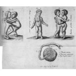 Acta medicorum Berolinensium: in incrimentum artis & scientiarum collecta