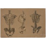 Burgmeyer, Josef: Torsostudie dreier Skelette