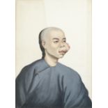 After Lamqua, 19th Century A group of five medical portraits depicting Chinese people with large...