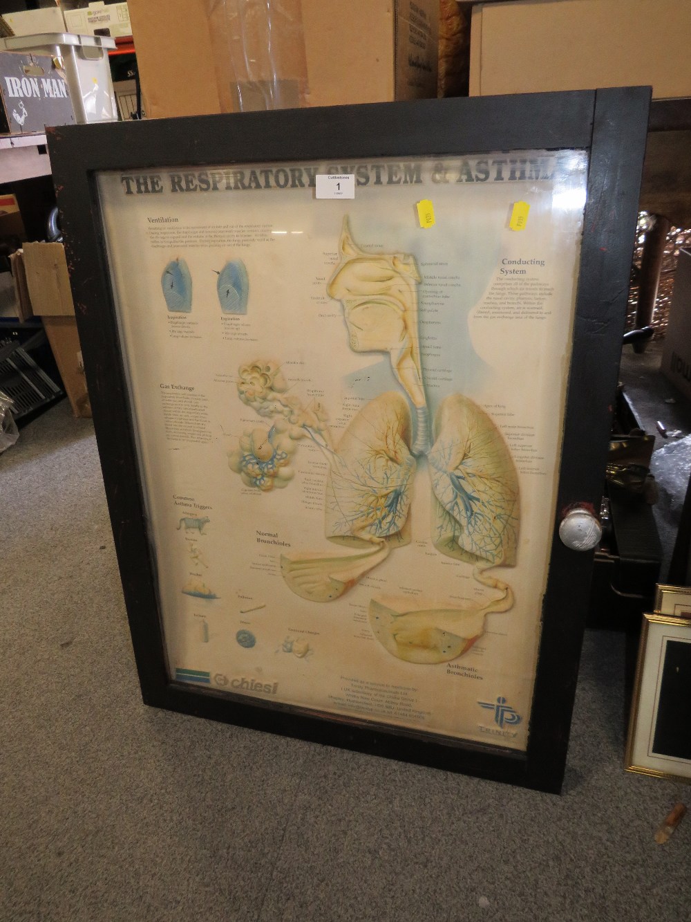 A DISPLAY CASE OF A TRINITY 3D DIAGRAM OF THE RESPIRATORY SYSTEM AND ASTHMA - H 76 CM BY W 58 CM