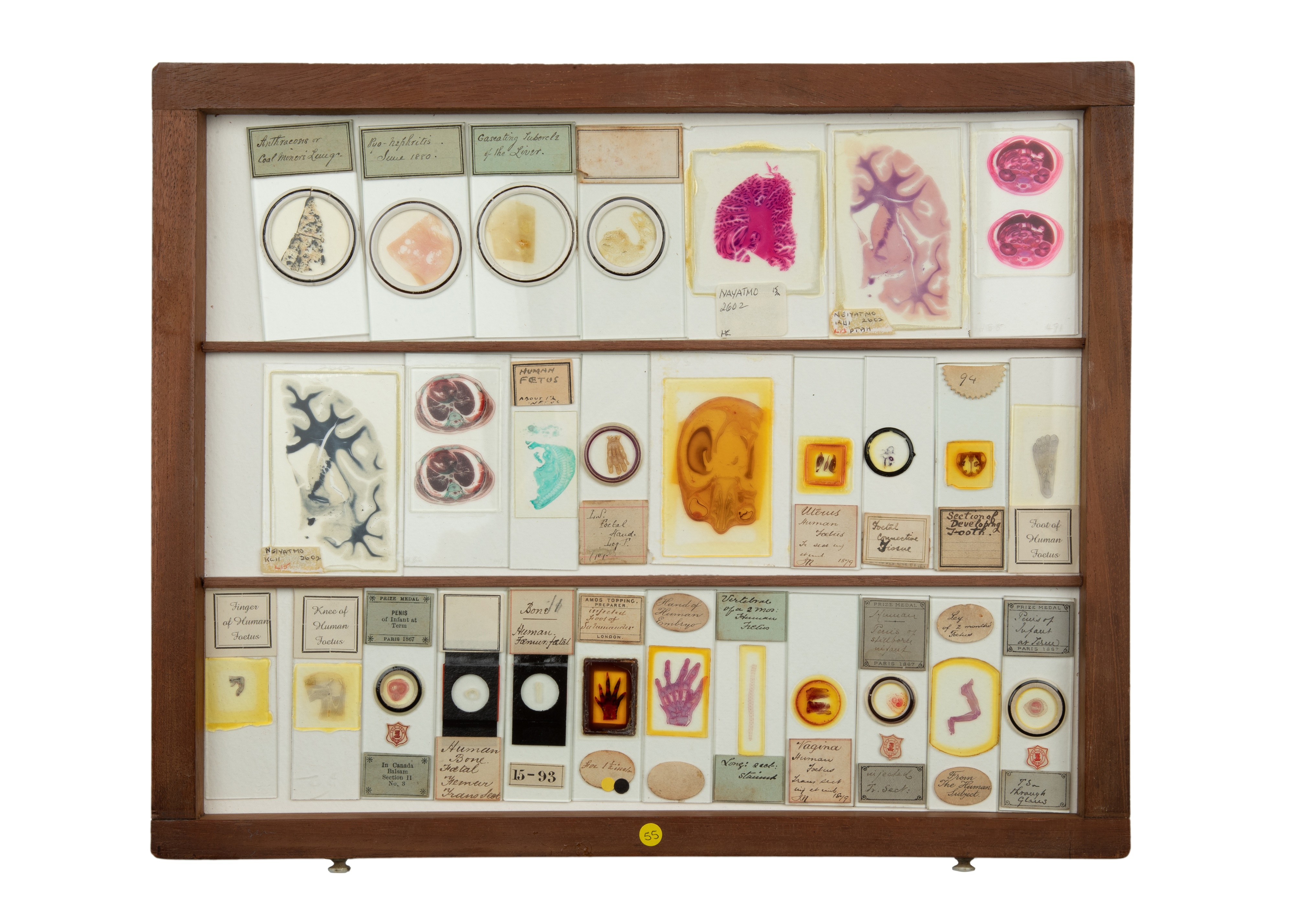 An Exceptional Single Owner Collection Of Victorian & Later Microscope Slides - Image 20 of 92