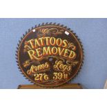 A Tattoos Removed painted sign