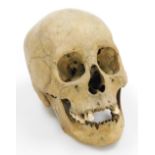 A human skull, 21cm wide.