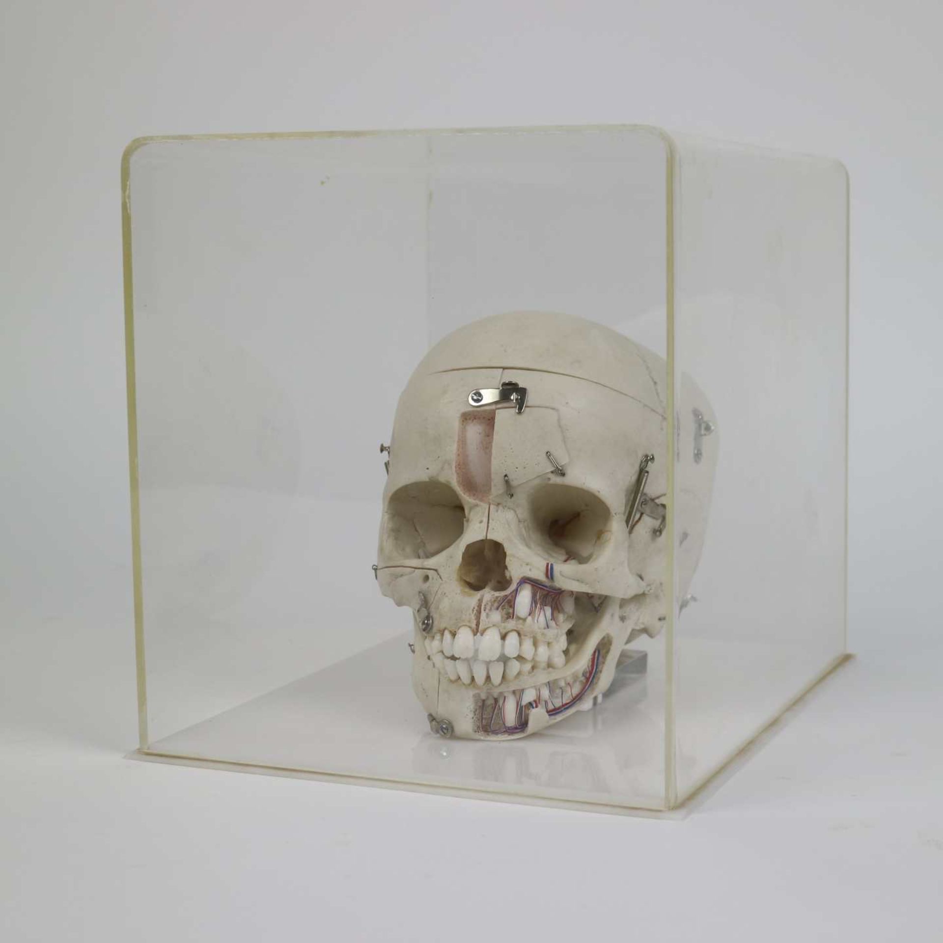 Study skull of a child - Image 2 of 6
