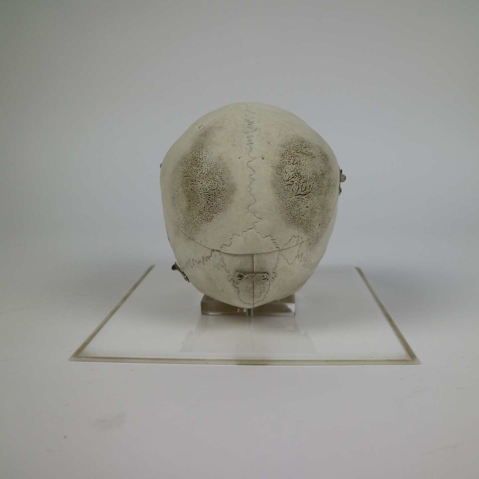 Study skull of a child - Image 4 of 6