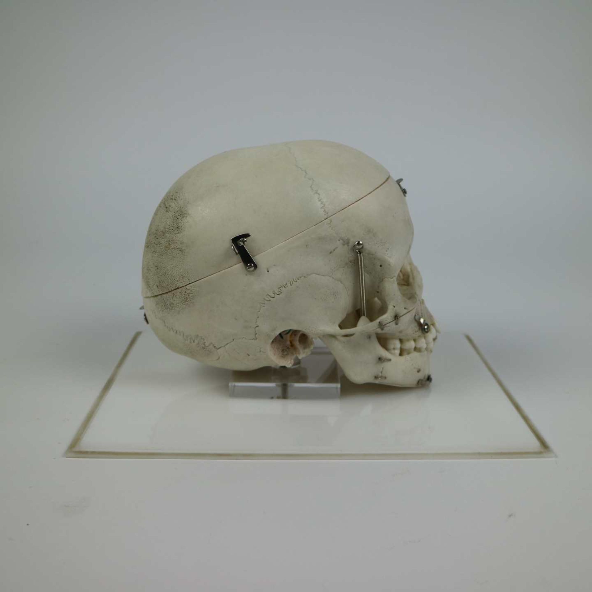 Study skull of a child - Image 5 of 6