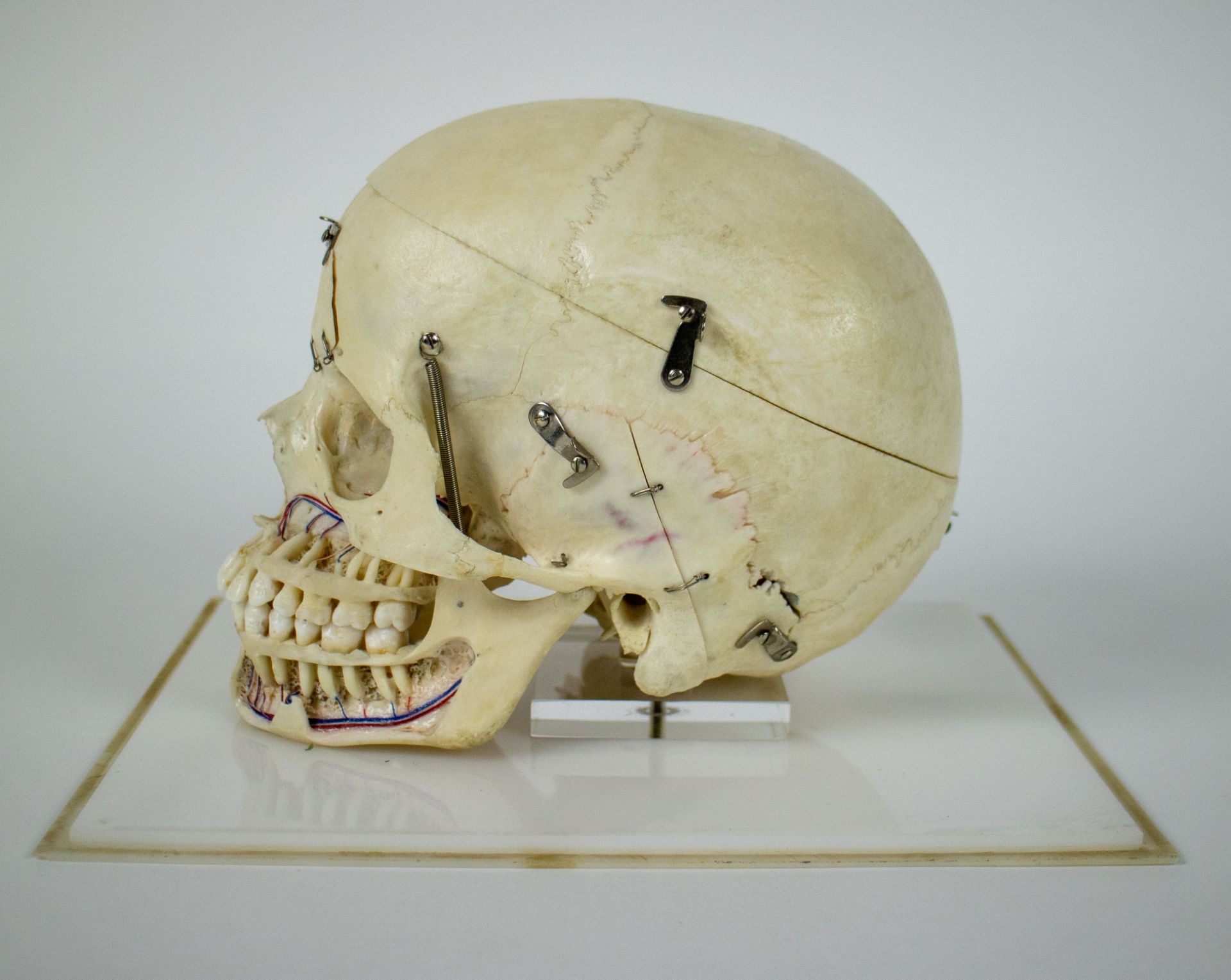 Study of a skull - Bild 4 aus 7