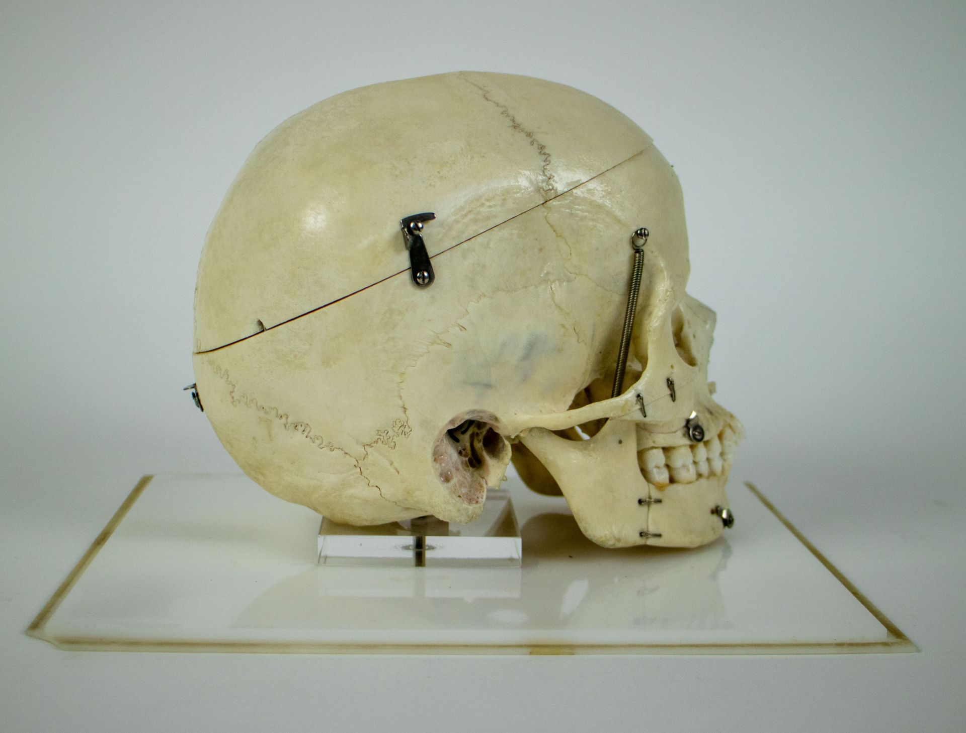 Study of a skull - Bild 6 aus 7
