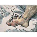 After James Gillray (1756-1815) British. "The Gout", Hand Coloured Etching, Published by Hannah
