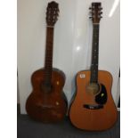 2x Acoustic Guitars