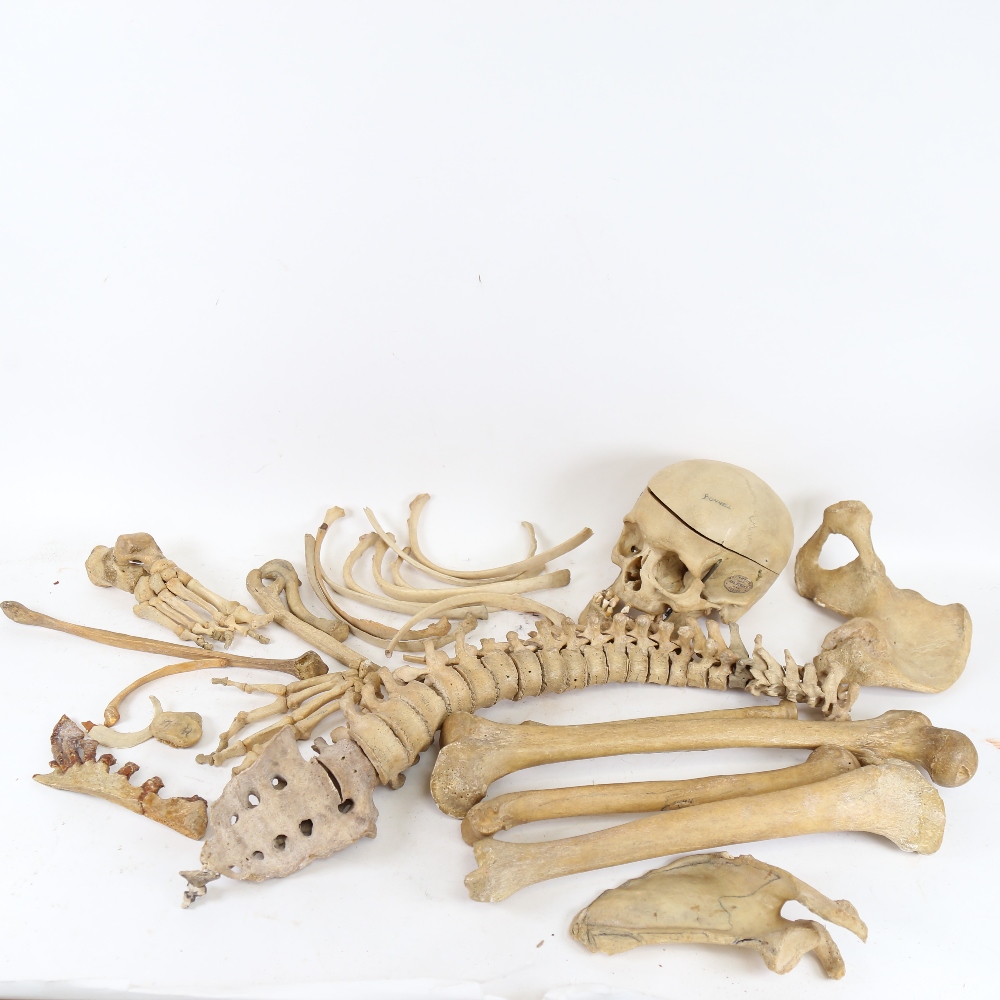 A 19th century human skeleton, in original Deal box with Millikin & Lawley label - Image 2 of 8