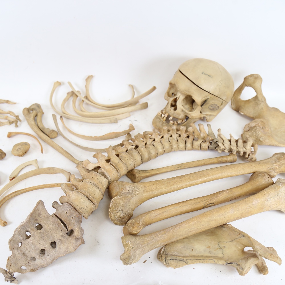 A 19th century human skeleton, in original Deal box with Millikin & Lawley label - Image 4 of 8