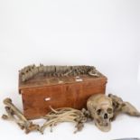 ANATOMY - a part human skeleton, including spine, skull, ribs etc, in wooden case