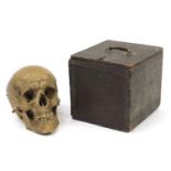 18th/19th century dissected medical human skull with Latin inscriptions and pine box, the skull 24cm