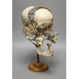 A human skull specimen, 1920s-30s, mounted in exploded form, adjustable brass arms and oak base,