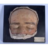 AN UNUSUAL FRENCH ANATOMICAL WAX STUDY OF A DISEASED FACE Folliculitis. 21 cm x 23 cm.