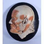 A FRENCH PAINTED POTTERY ANATOMICAL MODEL OF A CUT AWAY HUMAN SKULL depicting muscular structure upo