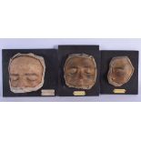 THREE RARE 19TH CENTURY EUROPEAN WAX SCIENTIFIC DISEASE DISPLAY BOARDS. Largest 21 cm square. (3)