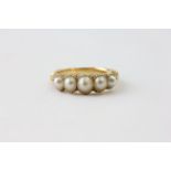 A FIVE STONE PEARL RING ON AN UNMARKED YELLOW METAL BAND(CONSIDERABLE WEAR), RING SIZE L/M,