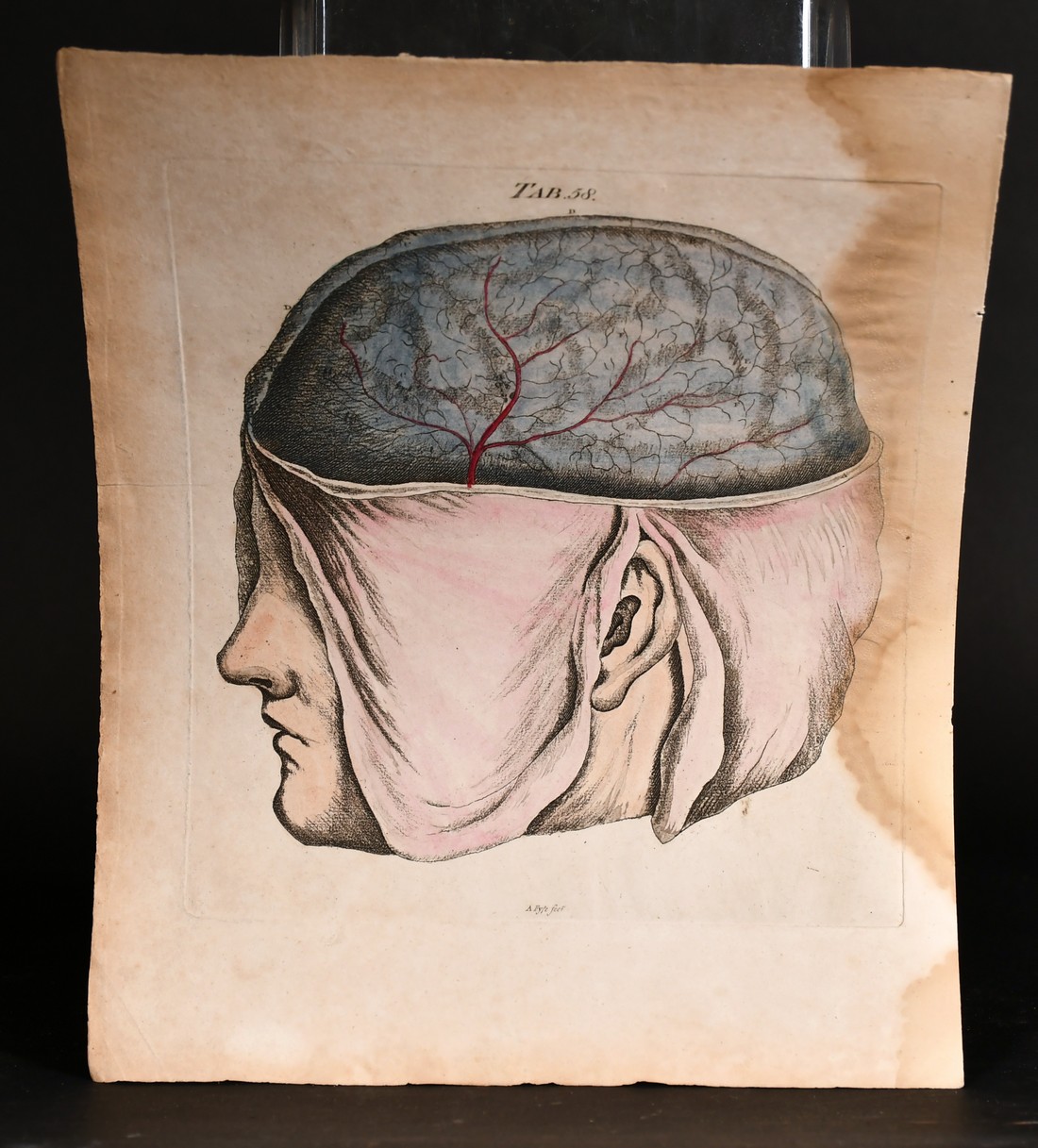 A. Fyfe, a group of 18th century anatomical prints, all 12" x 9.25", (5). - Image 3 of 6