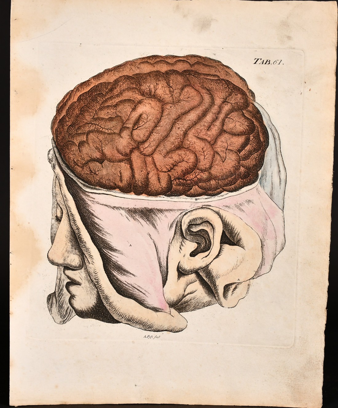 A. Fyfe, a group of 18th century anatomical prints, all 12" x 9.25", (5). - Image 2 of 6