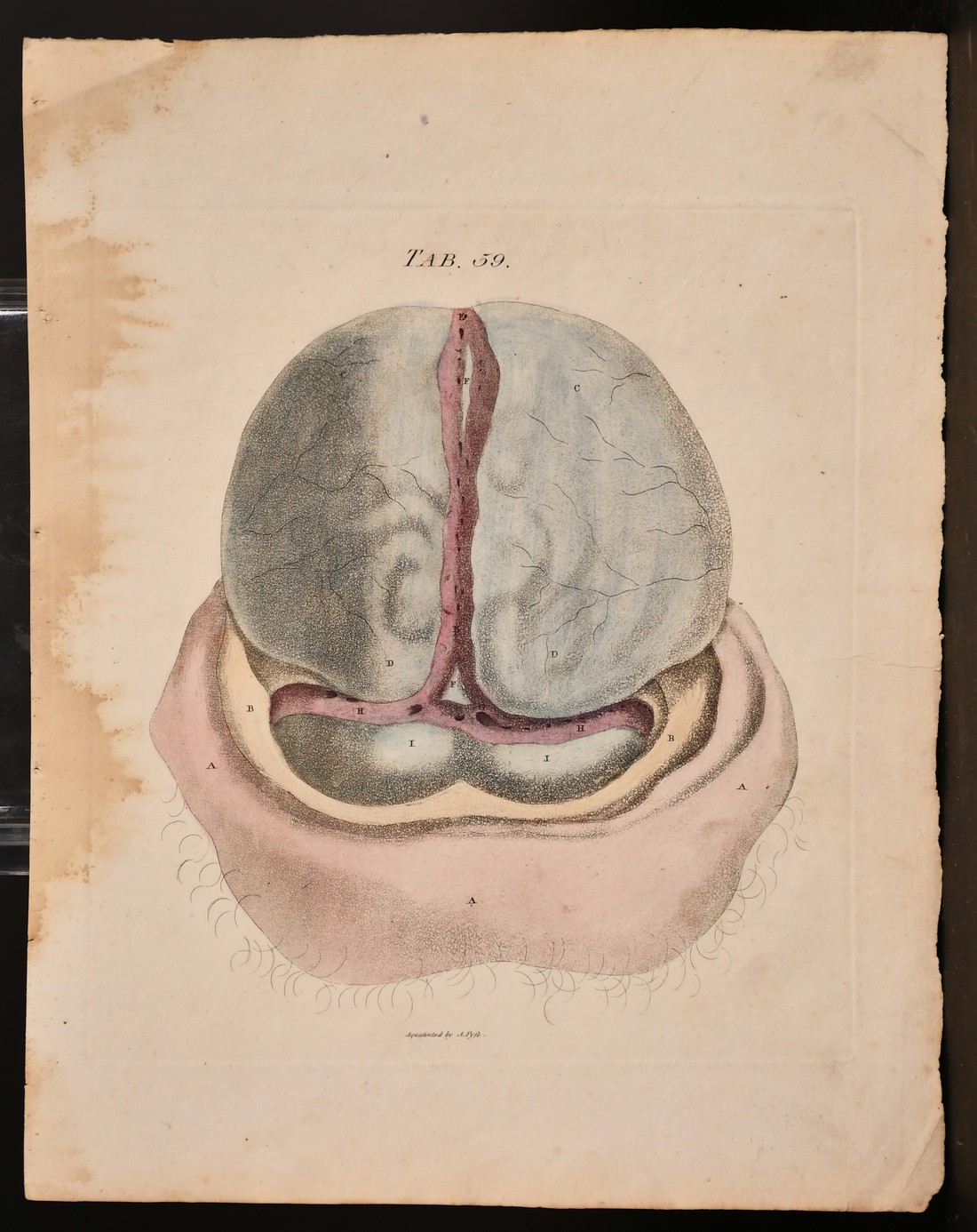 A. Fyfe, a group of 18th century anatomical prints, all 12" x 9.25", (5). - Image 4 of 6
