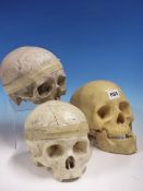 A HUMAN SKULL TOGETHER WITH TWO MEDICAL EDUCATIONAL SKULLS