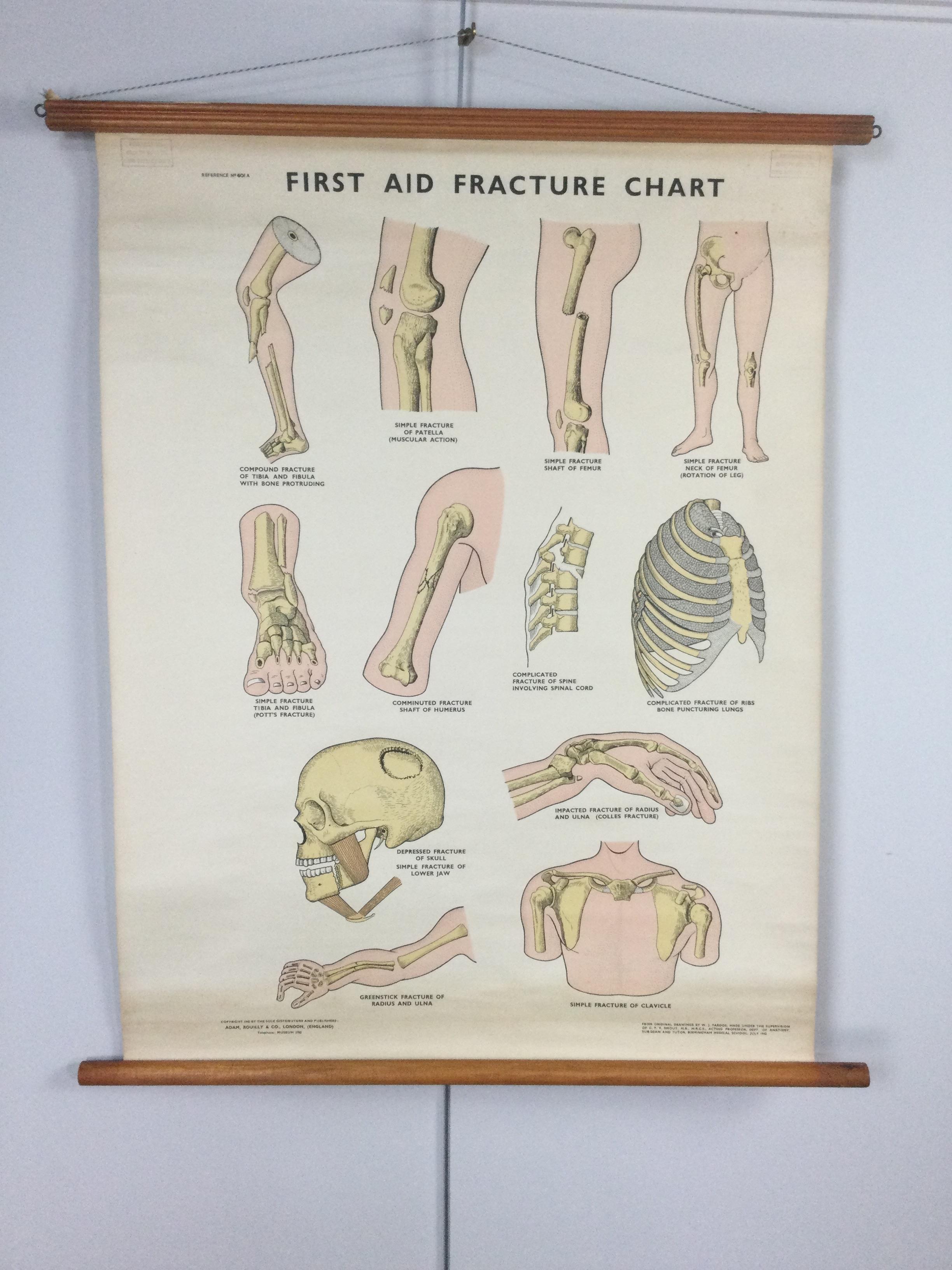 A LARGE VINTAGE ANATOMICAL CHART - Image 2 of 4