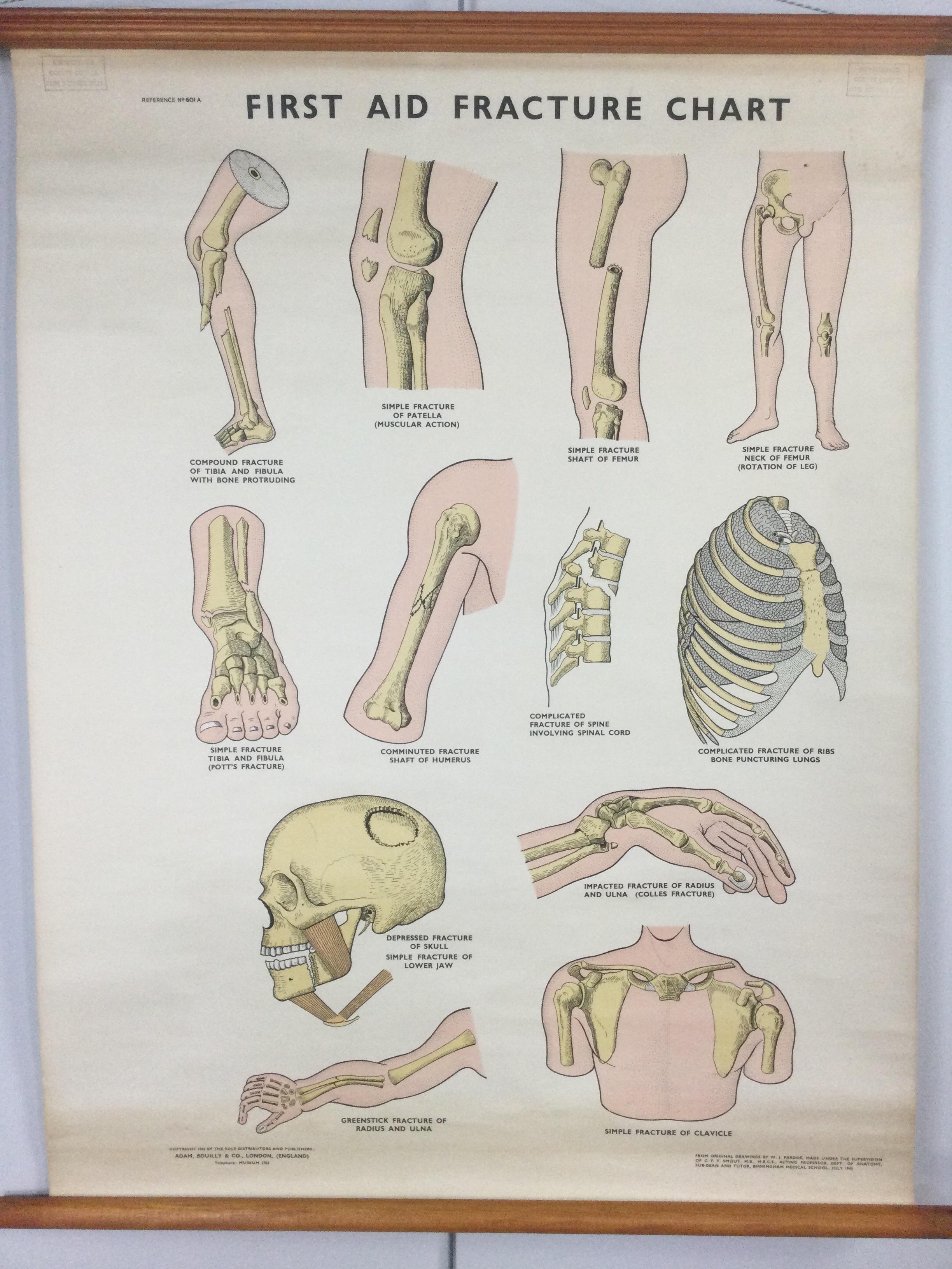 A LARGE VINTAGE ANATOMICAL CHART