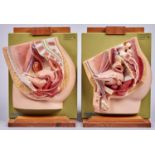 Anatomy. Two Somso painted plastic models of the mediam section of the male and female pelvises,