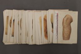 A collection of medical plates. Each approximately 11.5 x 18.5 cm.