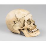 A LATE 19TH CENTURY HUMAN SKULL WITH SPRUNG JAW AND REMOVABLE TOP (h 15.5cm x w 13.5cm x d 23cm)