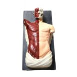 An Adam,Rouilly anatomical torso,