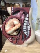 A 20th century anatomical model of a baby in the womb