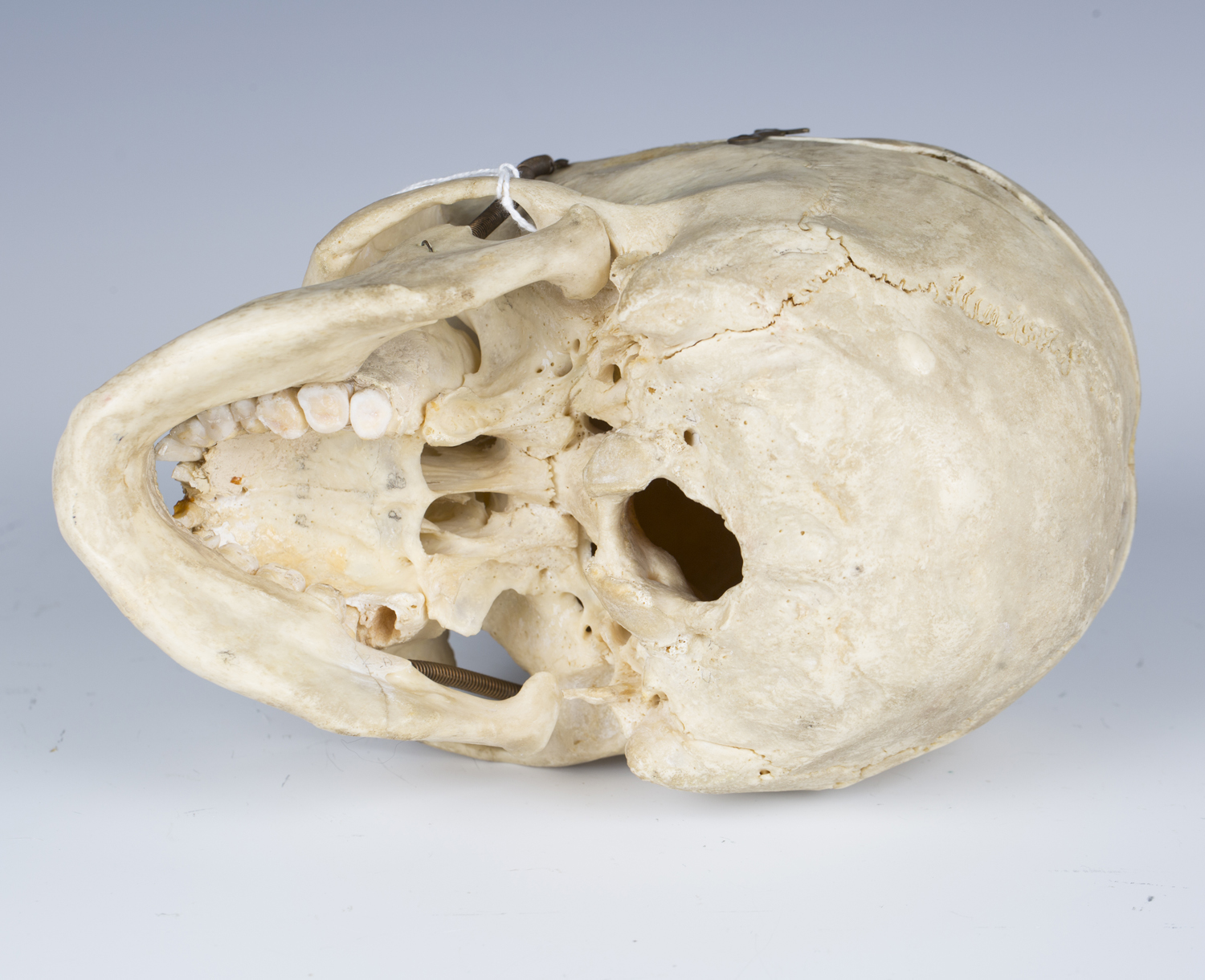 A human skull with hinged cranium and sprung jaw.Buyer’s Premium 29.4% (including VAT @ 20%) of - Image 2 of 4