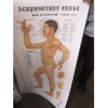 3 acupuncture posters